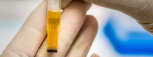 urine sample used for drug test